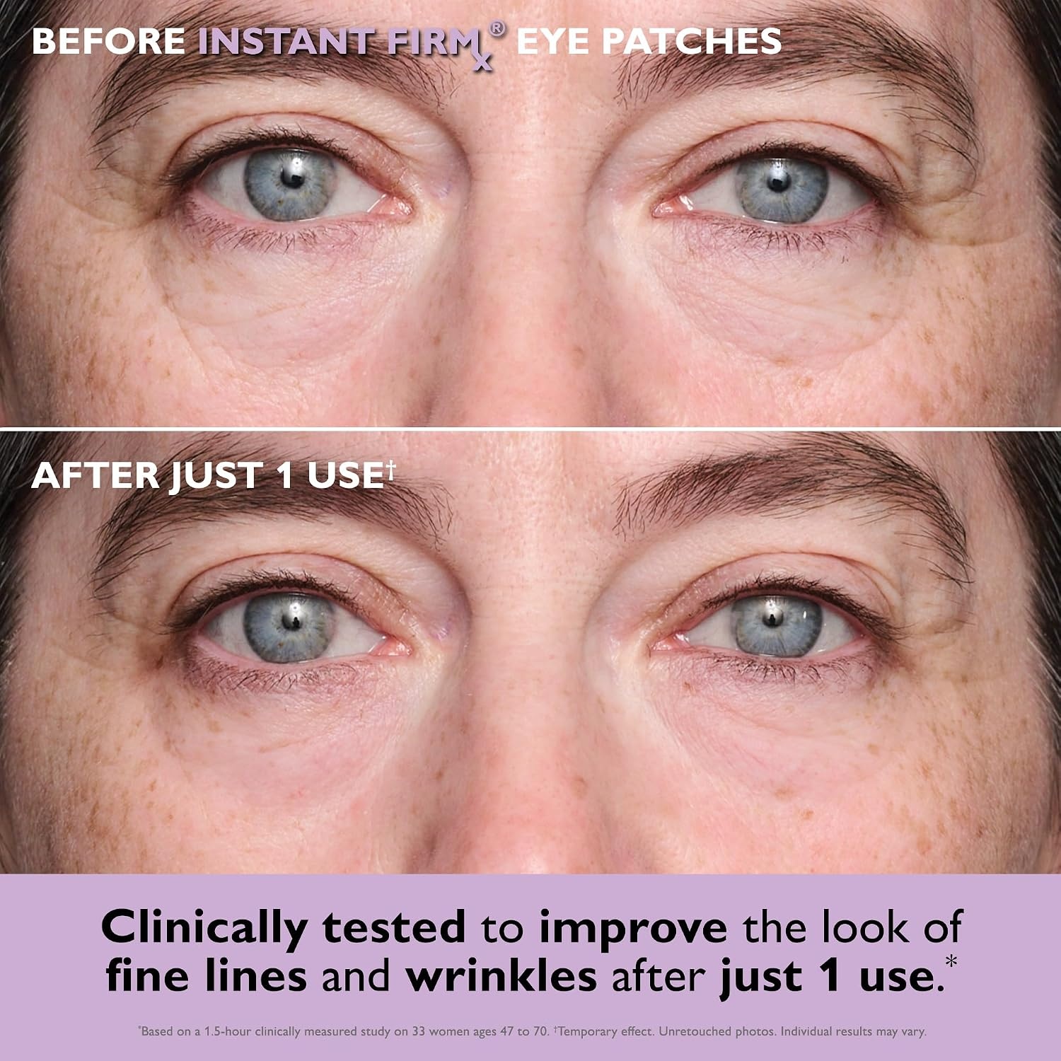 image:imagePeter Thomas Roth Eye Patch Travel Pack 4 Pairs 8 Patches Eye Masks for Fine Lines Dark Circles Puffiness and Dryness