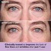 Peter Thomas Roth | Instant FIRMx Collagen Tightening Eye Patches Double Pack| Eye Patches For Firming Under-Eye Bags & Wrinkles | Eye Masks For Puffiness